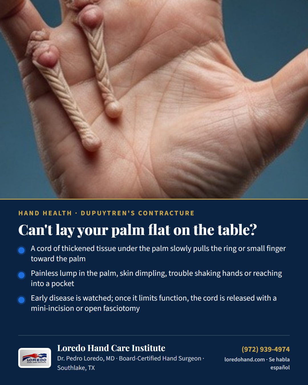 Can't lay your palm flat on the table? Loredo Hand Care Institute patient education card