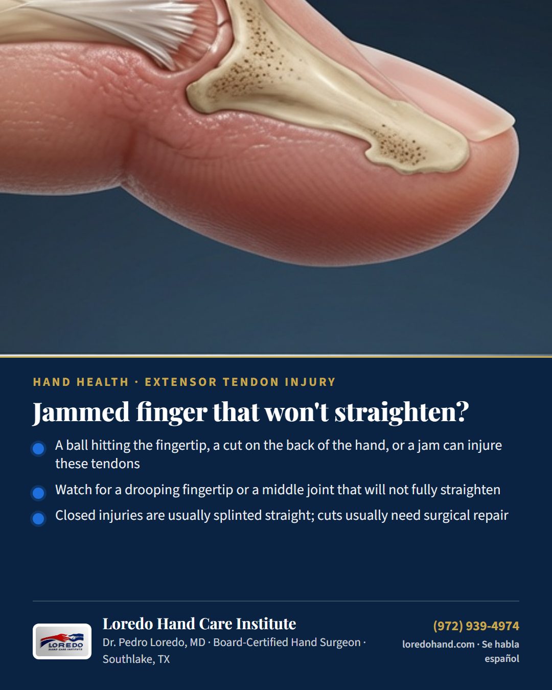 Jammed finger that won't straighten? Loredo Hand Care Institute patient education card