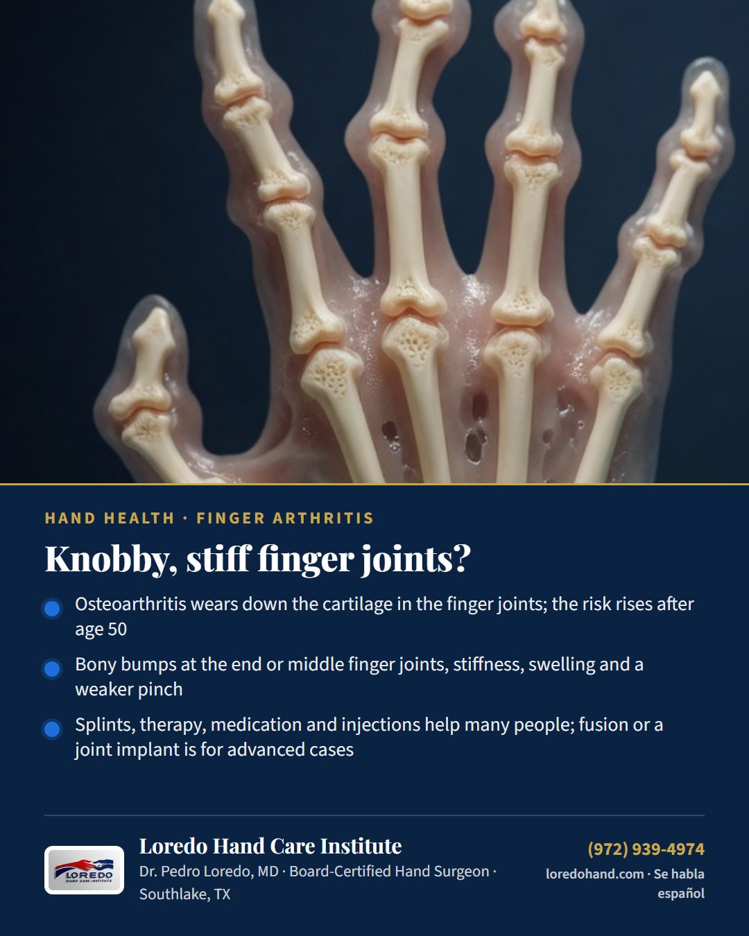 Knobby, stiff finger joints? Loredo Hand Care Institute patient education card