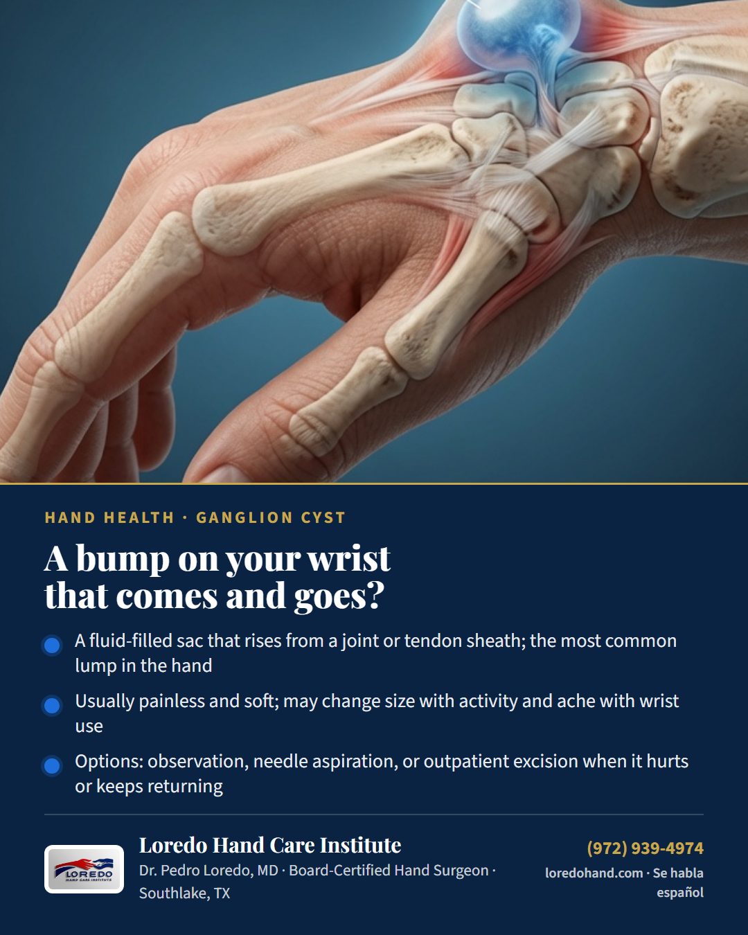 A bump on your wrist that comes and goes? Loredo Hand Care Institute patient education card